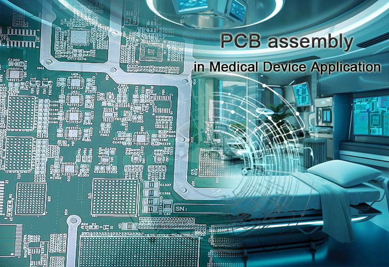 PCB assembly in medical device application